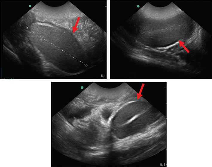 Fig. 18.