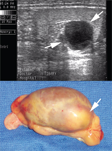 Fig. 12.