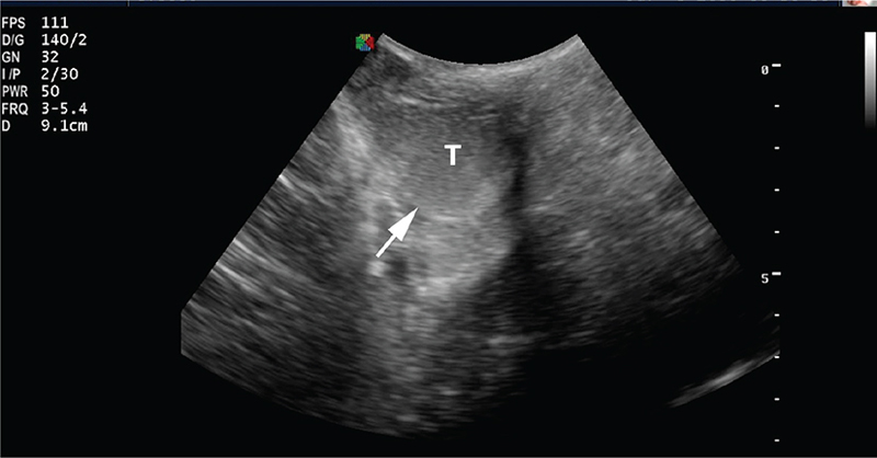 Fig. 16.