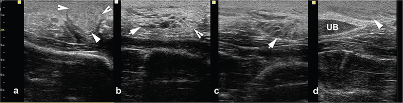 Fig. 20.